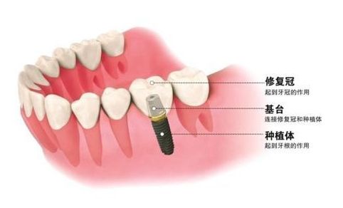 http://www.bstoo.cn/d/file/price/loytxawrj2a2.jpg