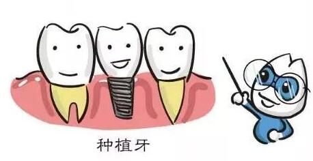 http://www.bstoo.cn/d/file/price/lsl3jkbm1km0.jpg