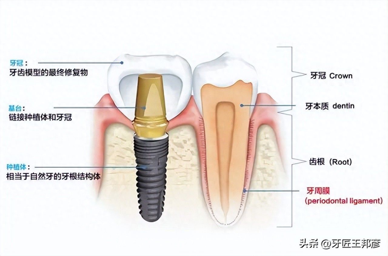 http://www.bstoo.cn/d/file/price/lt5r6egtxys6.jpg