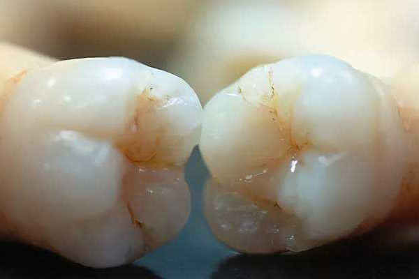 http://www.bstoo.cn/d/file/price/lv02odi9ca5n.jpg