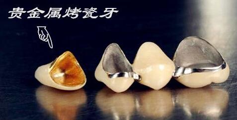 http://www.bstoo.cn/d/file/price/m5cidp8nkqq6.jpg