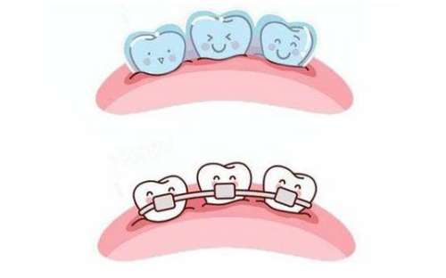 http://www.bstoo.cn/d/file/price/mnt6g1skey.jpg