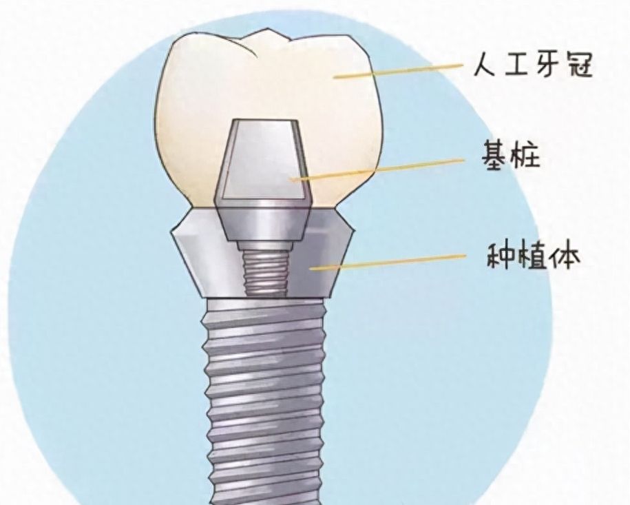 http://www.bstoo.cn/d/file/price/mx8pxxk8j2ak.jpg