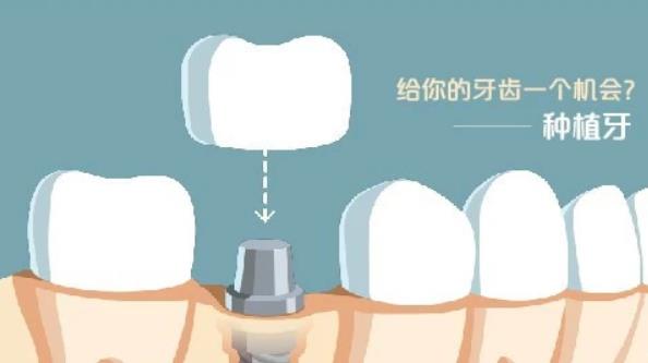 http://www.bstoo.cn/d/file/price/n1h8y547aw.jpg