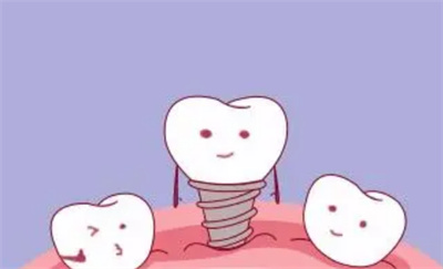 http://www.bstoo.cn/d/file/price/n1jx35t36a83.jpg