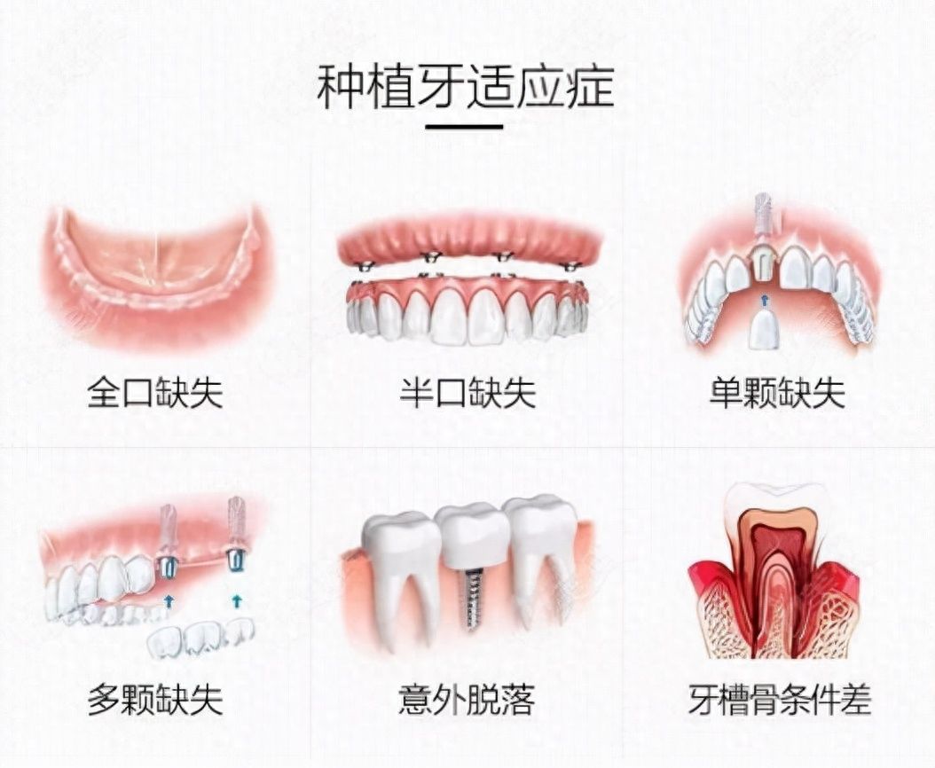 http://www.bstoo.cn/d/file/price/n4drw4r0hmg6.jpg