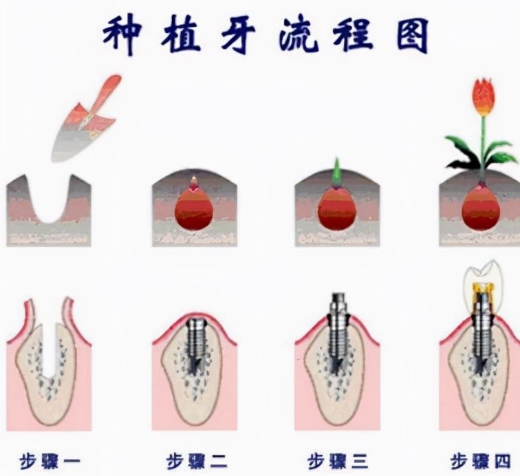 http://www.bstoo.cn/d/file/price/nbyvvwij846e.jpg