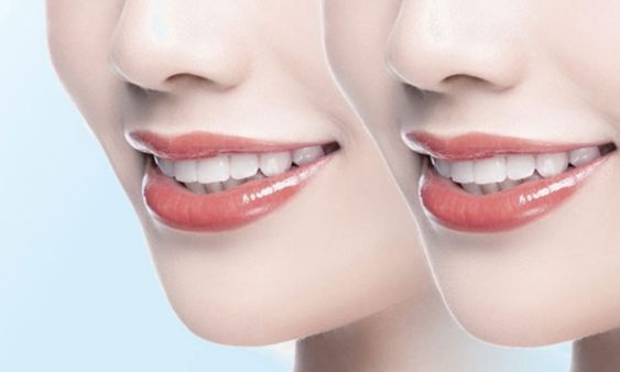 http://www.bstoo.cn/d/file/price/nfle7elg7ld4.jpg