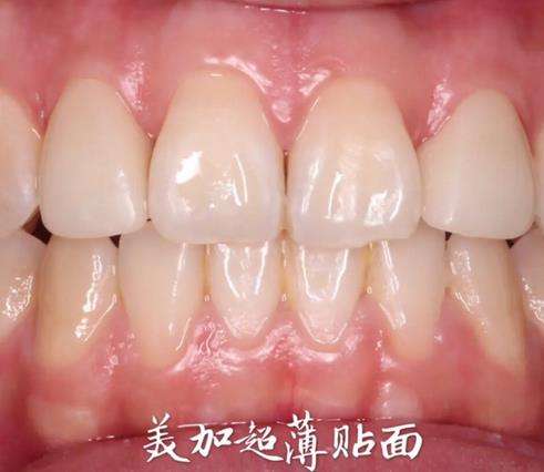 http://www.bstoo.cn/d/file/price/nma0klz71cqh.jpg