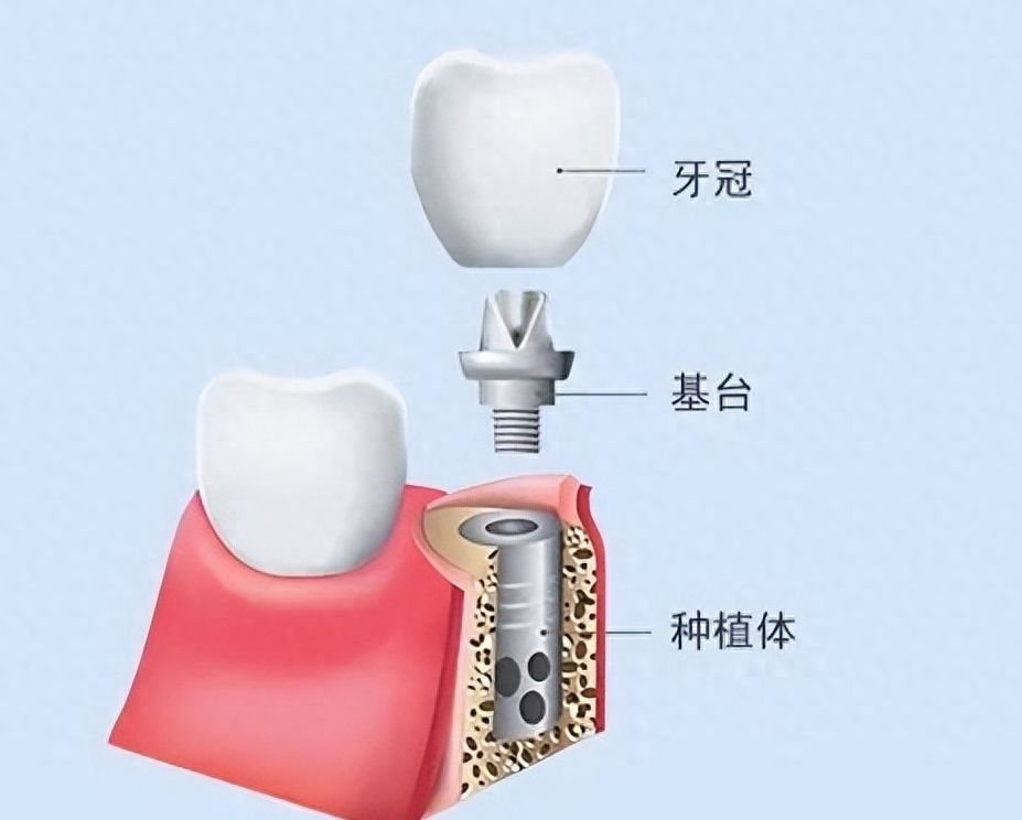 http://www.bstoo.cn/d/file/price/p29ao7bpr54u.jpg