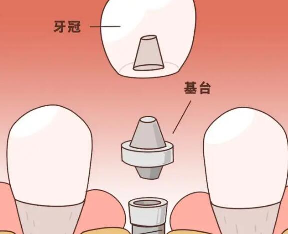 http://www.bstoo.cn/d/file/price/p56cnrncptfi.jpg