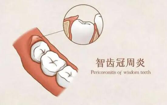 http://www.bstoo.cn/d/file/price/phjzqfbzliss.jpg