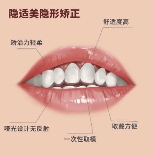 渭南口腔美容：進(jìn)口種植牙價(jià)格與青少年矯正費(fèi)用