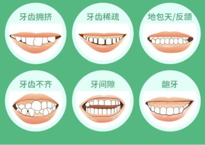 http://www.bstoo.cn/d/file/price/pt7crcvzc7u6.jpg