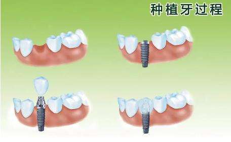 http://www.bstoo.cn/d/file/price/pz2ji9r1wgdh.jpg
