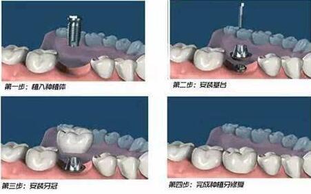 http://www.bstoo.cn/d/file/price/q2m5ybdqv1rd.jpg