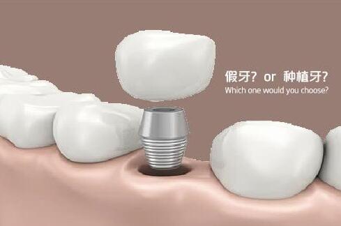 http://www.bstoo.cn/d/file/price/q3imexb1dn72.jpg