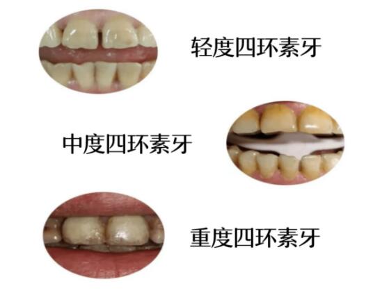 http://www.bstoo.cn/d/file/price/qc3aaxzp4lzn.jpg
