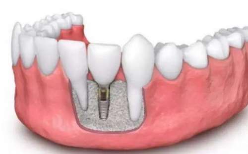 http://www.bstoo.cn/d/file/price/qc91aqiglg.jpg
