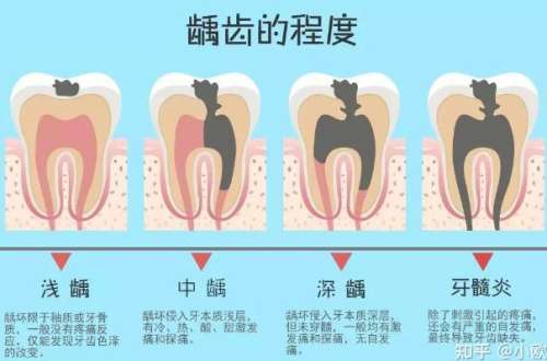 http://www.bstoo.cn/d/file/price/qnpg9cu1k8lr.jpg