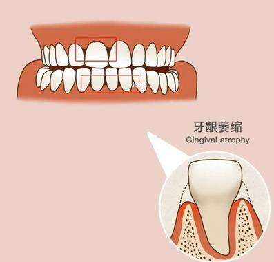 http://www.bstoo.cn/d/file/price/qom9otoshtfx.jpg
