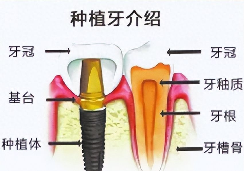 http://www.bstoo.cn/d/file/price/r35wa0hhkxoa.jpg