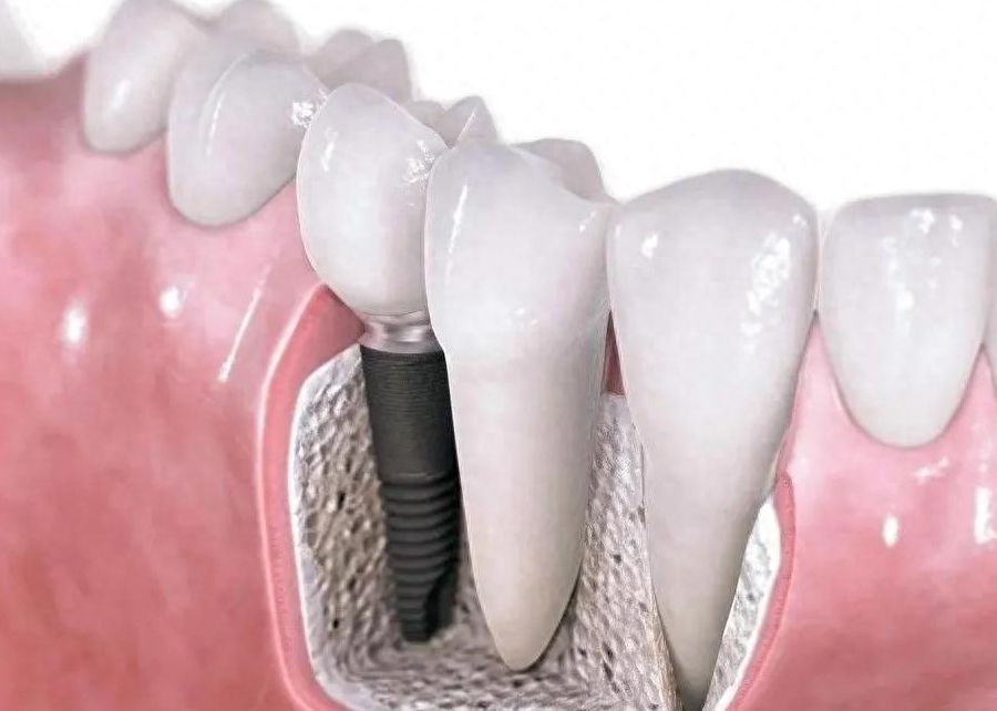 http://www.bstoo.cn/d/file/price/r6gv92tbsh5l.jpg