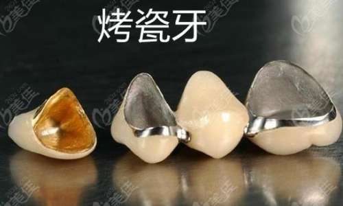 http://www.bstoo.cn/d/file/price/rzhl4zdy02m9.jpg