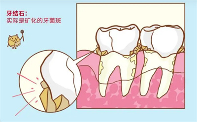 http://www.bstoo.cn/d/file/price/sd2tesja88.jpg