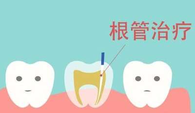 詳解：氧化鋁全瓷牙與二氧化鋯全瓷牙，一顆多少錢？
