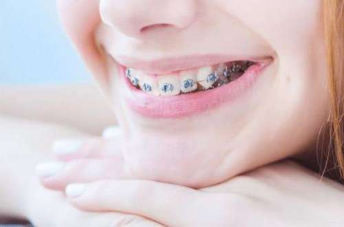 http://www.bstoo.cn/d/file/price/src0fl1hclv4.jpg