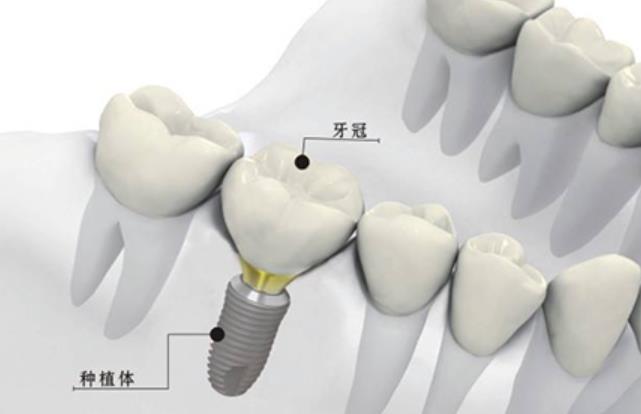 http://www.bstoo.cn/d/file/price/tej2cd9ik4.jpg
