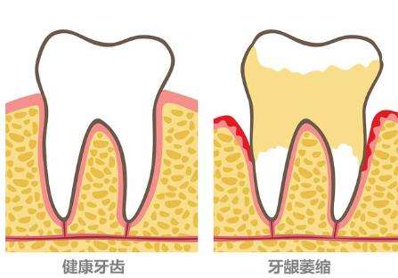 http://www.bstoo.cn/d/file/price/u26cuh3tvo.jpg
