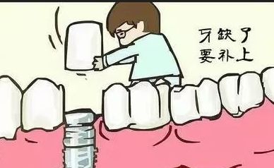 貴港同步口腔種植牙價(jià)格全揭曉！