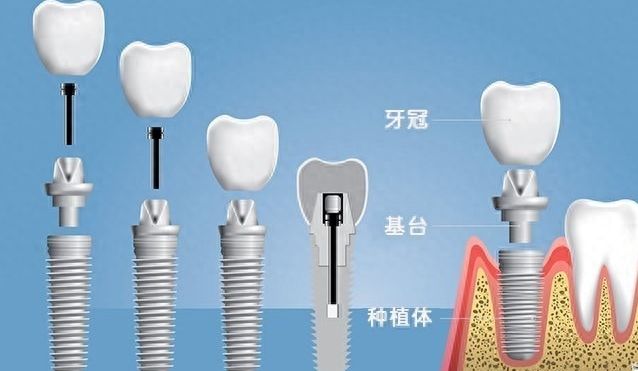 http://www.bstoo.cn/d/file/price/v262o9tzgvaw.jpg