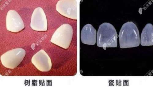 http://www.bstoo.cn/d/file/price/v9y1khxznw4b.jpg