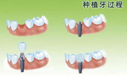 http://www.bstoo.cn/d/file/price/vhn5532i6a4t.jpg