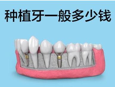 http://www.bstoo.cn/d/file/price/vkdhw0s1pj4y.jpg