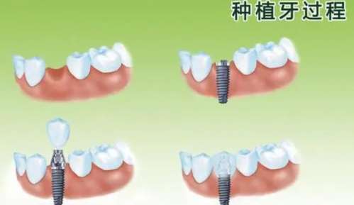 http://www.bstoo.cn/d/file/price/vmyy82vygo94.jpg