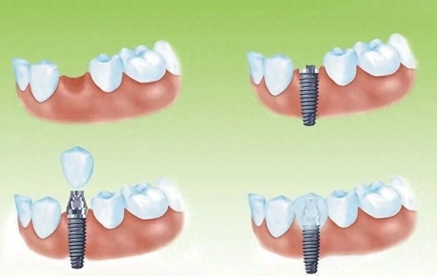 http://www.bstoo.cn/d/file/price/vu4eacx3km5t.jpg