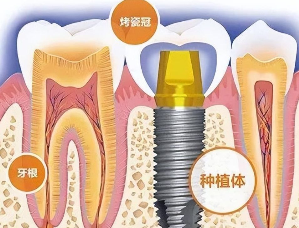 http://www.bstoo.cn/d/file/price/w2yzxluai6er.jpg