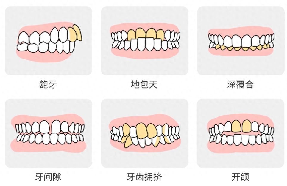 http://www.bstoo.cn/d/file/price/w6lh9lo9503z.jpg