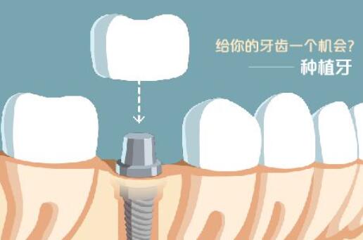 http://www.bstoo.cn/d/file/price/whjkopl9ej2a.jpg