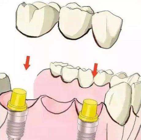 http://www.bstoo.cn/d/file/price/wj2n6ixgs3hk.jpg
