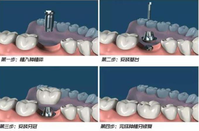 http://www.bstoo.cn/d/file/price/xexsdr8biy.jpg
