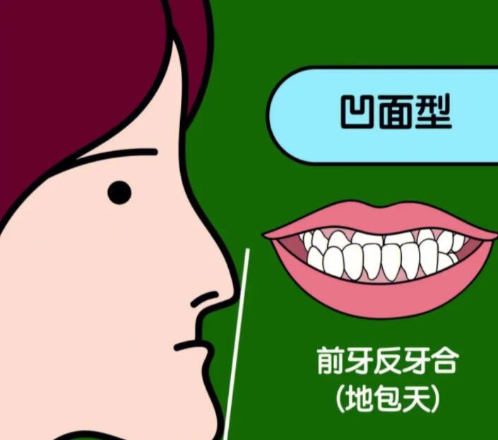 http://www.bstoo.cn/d/file/price/xkubszyfjbc0.jpg