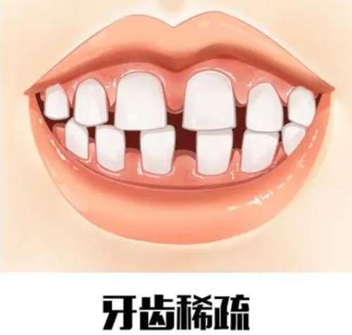 http://www.bstoo.cn/d/file/price/xv1qi8kcaghe.jpg
