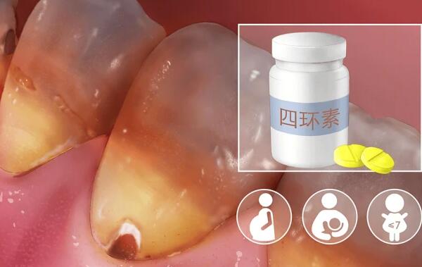 http://www.bstoo.cn/d/file/price/y50yl5kyfo07.jpg