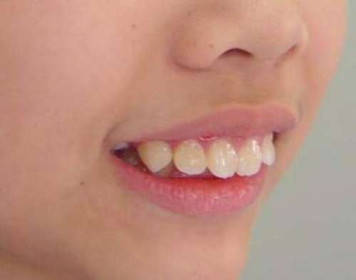 http://www.bstoo.cn/d/file/price/ya304gbus1.jpg