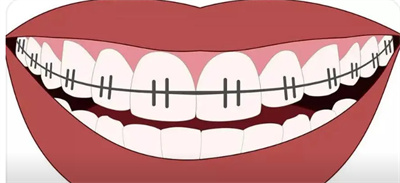 http://www.bstoo.cn/d/file/price/ydfu9jti7uvj.jpg